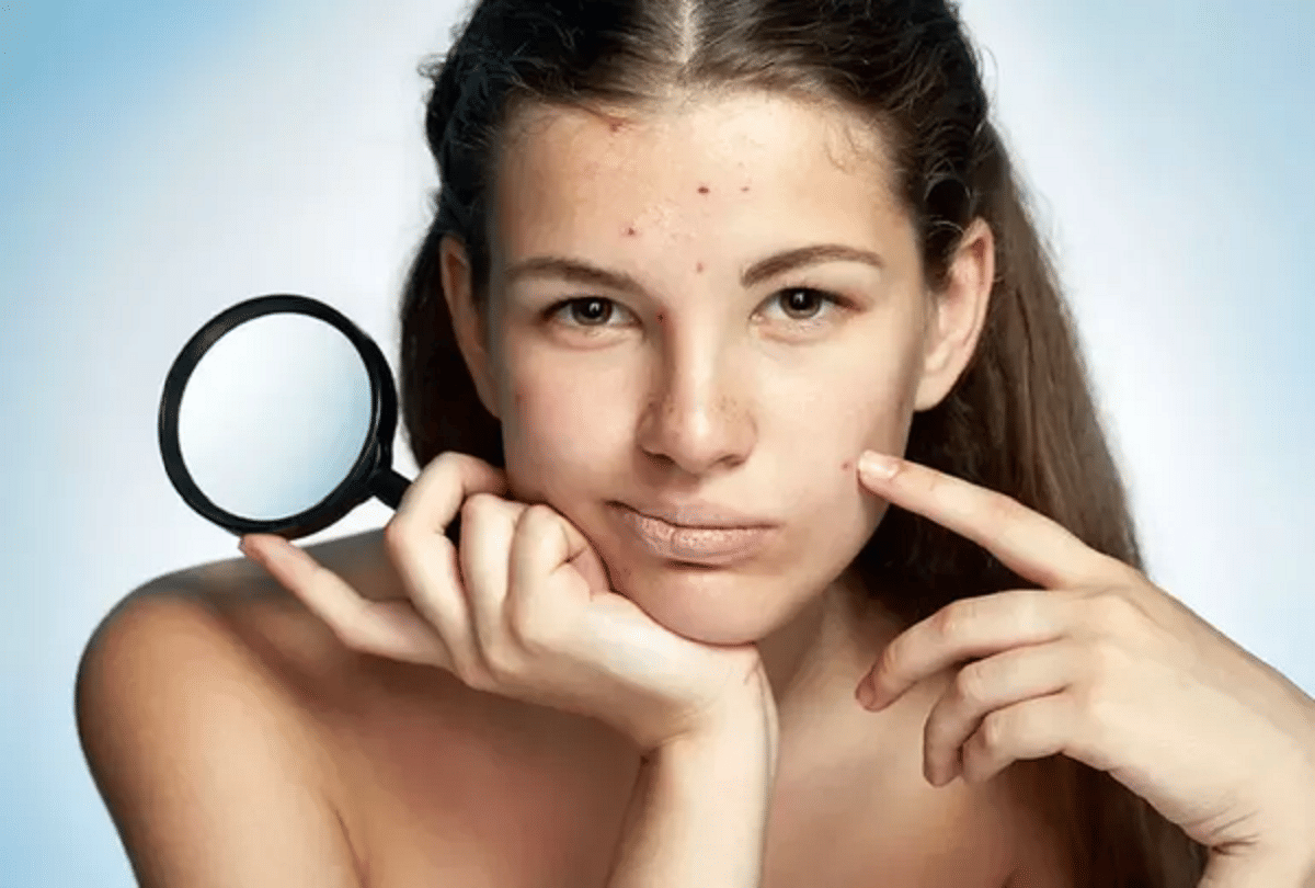 apply ice cube will provide relief from problems like rashes and rash in summer