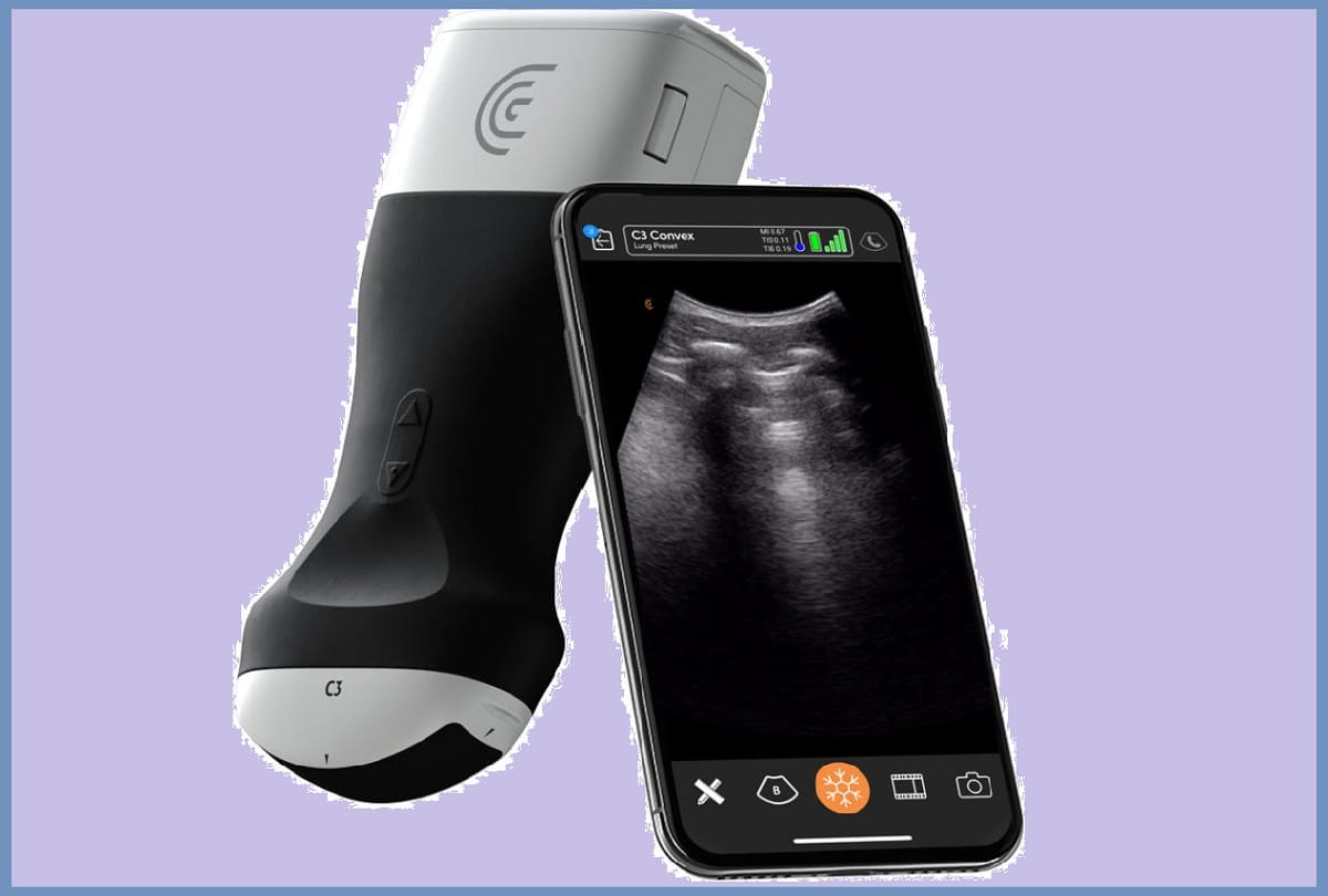 Coronavirus Latest Research Updates: UBC researchers use technology to speed up COVID-19 diagnoses portable Ultrasound Scanner