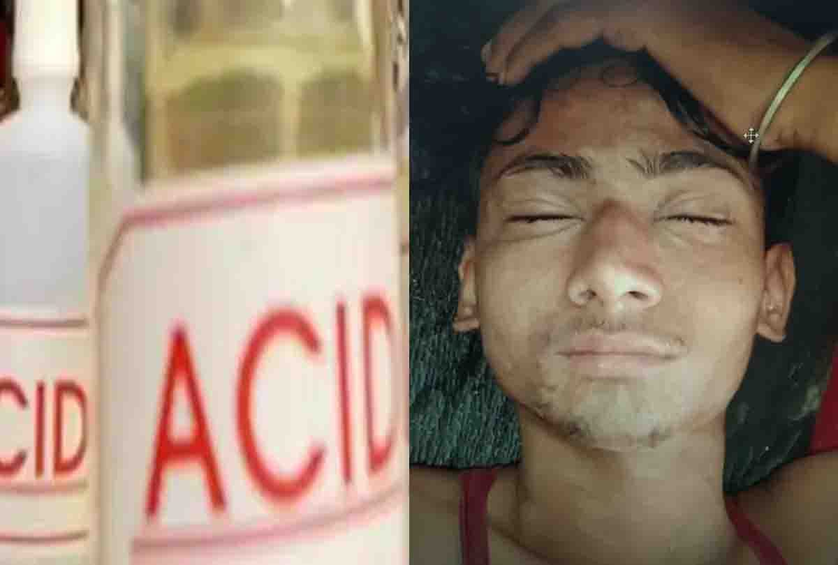 UP: girl attacked with acid on boy, dispute over tying buffalo