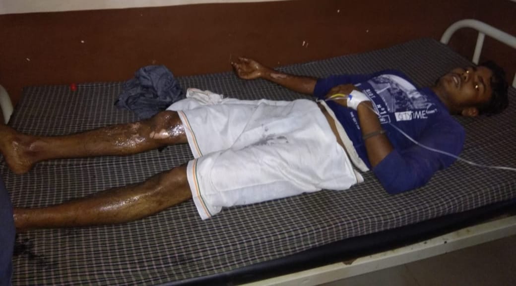Two laborers scorched in the machine while putting linter
