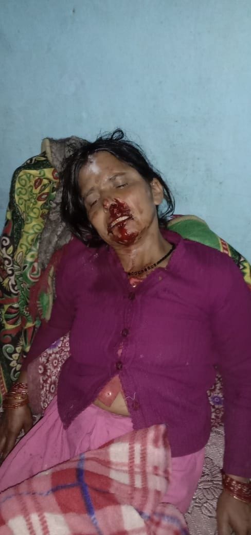 Woman injured by leopard attack to save cow