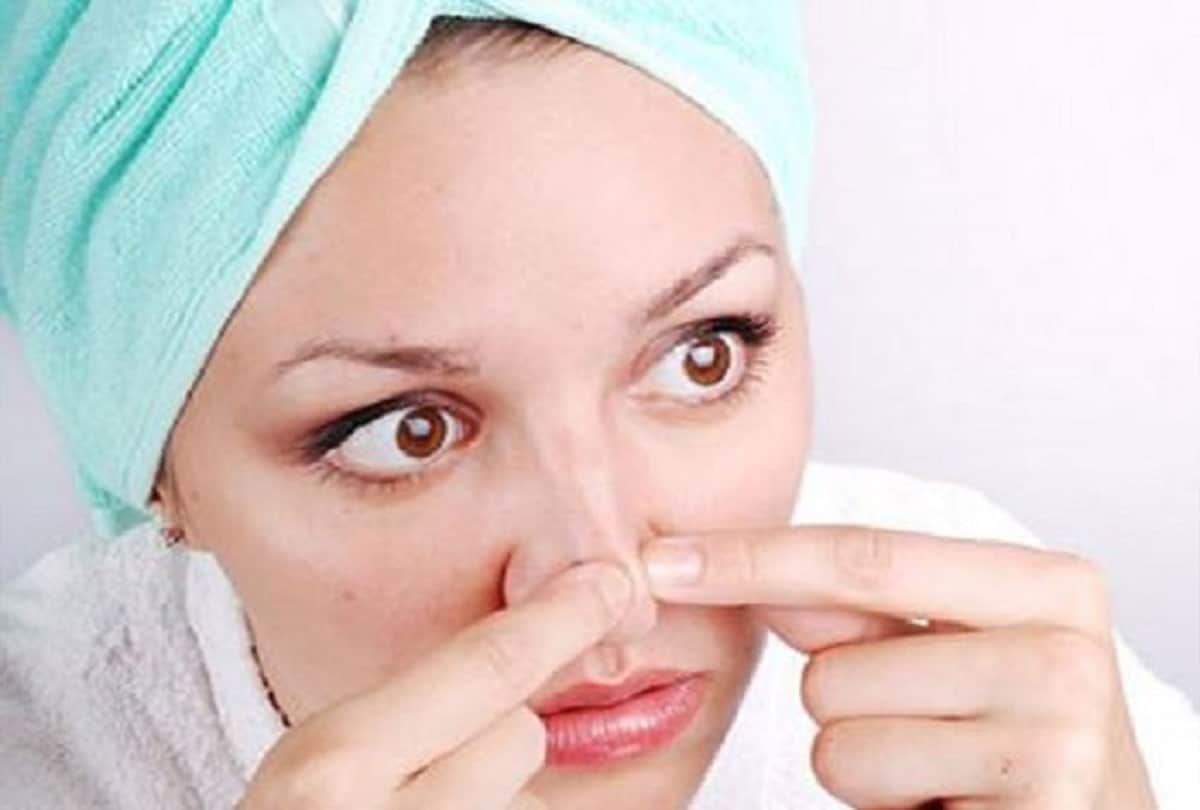 blackheads removal from nose at home with stripe must take care these things