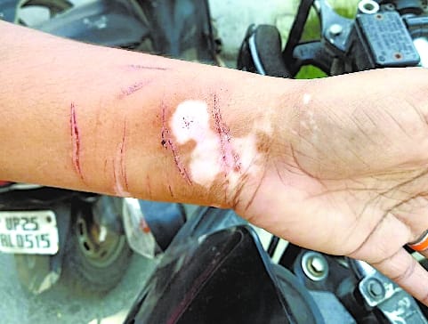 Desperate from the police, the woman cut the nerve of the hand