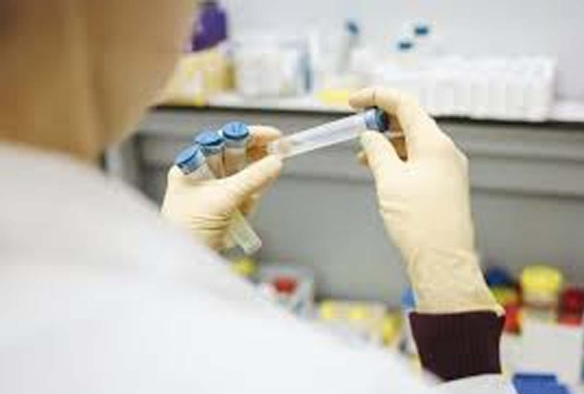Coronavirus in unnao: 9 more corona positive found in Unnao, 116 infected