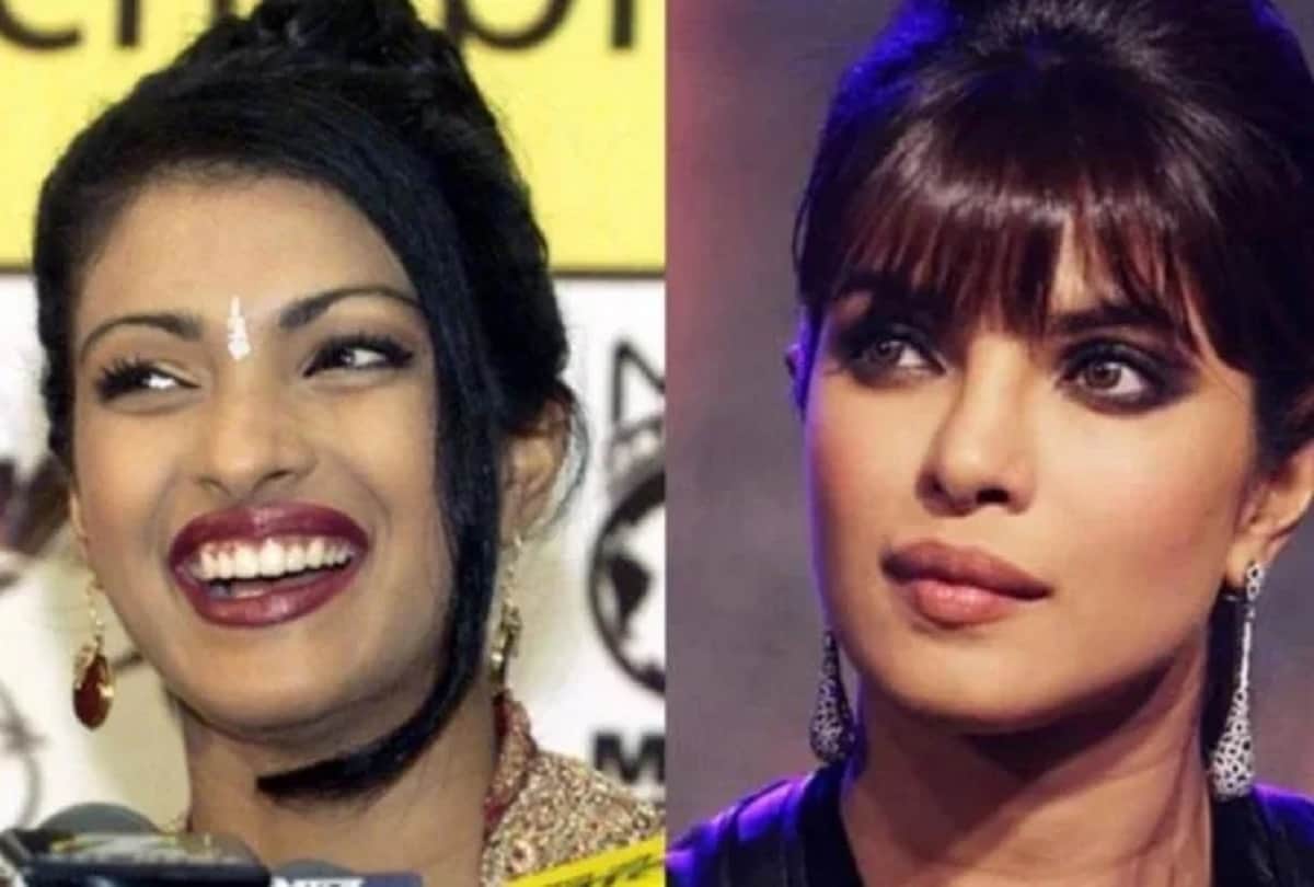 how Bollywood actresses looked before plastic surgery Anushka Sharma to Priyanka Chopra