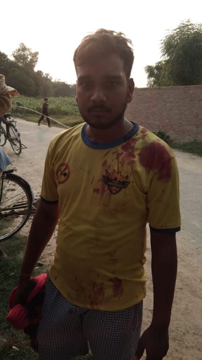 Pratapgarh: Ten people injured in bloody conflict in two sides