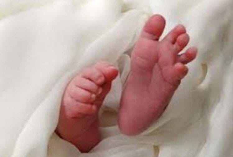 one of the twins died due to doctor's negligence