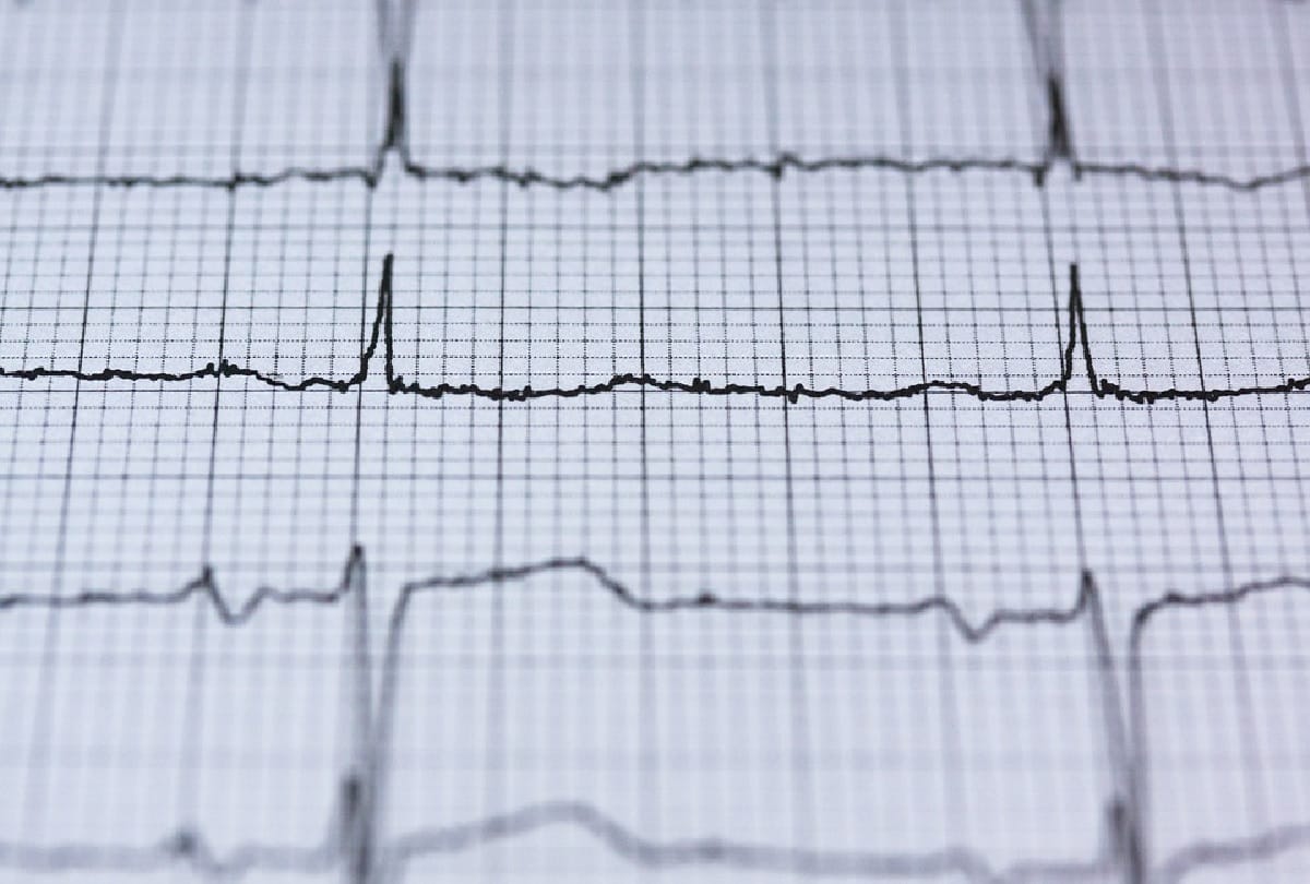 heart attack risk calculator know test to determine heart attack risk in hindi