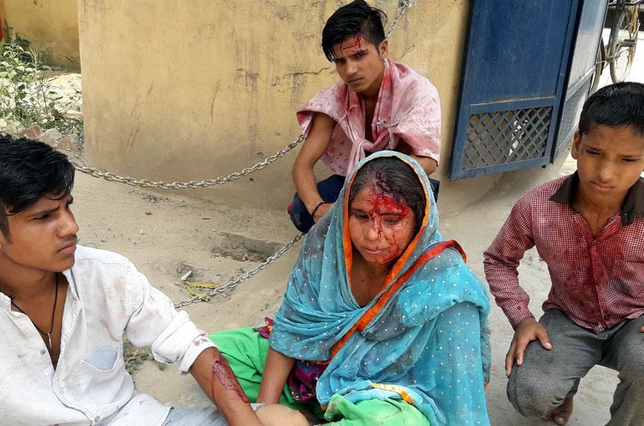 Five members of a family injured after being attacked