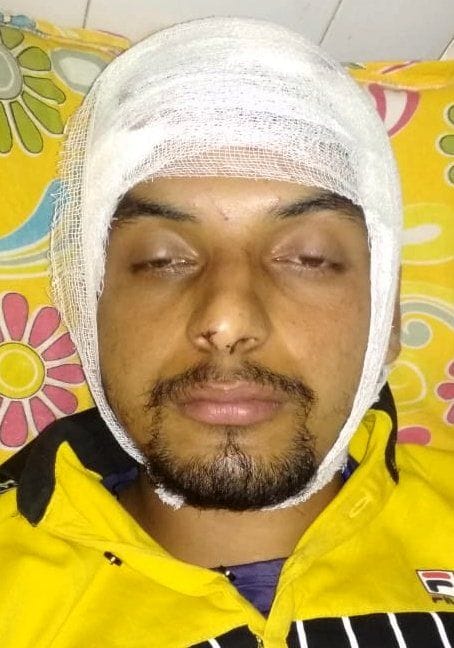 Bhuvan of Bhatigaon clashed with leopard, forced to flee
