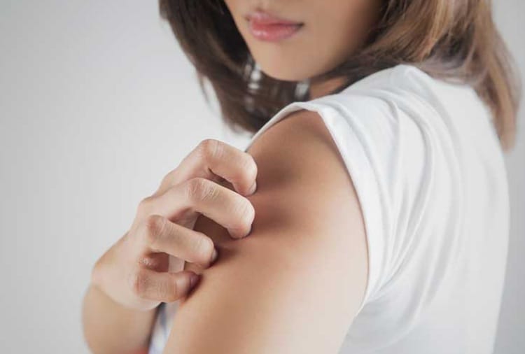 Heat, Summer Season, Home Remedies for Skin Disease