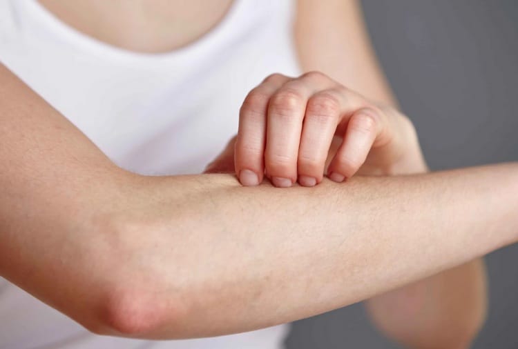 Heat, Summer Season, Home Remedies for Skin Disease