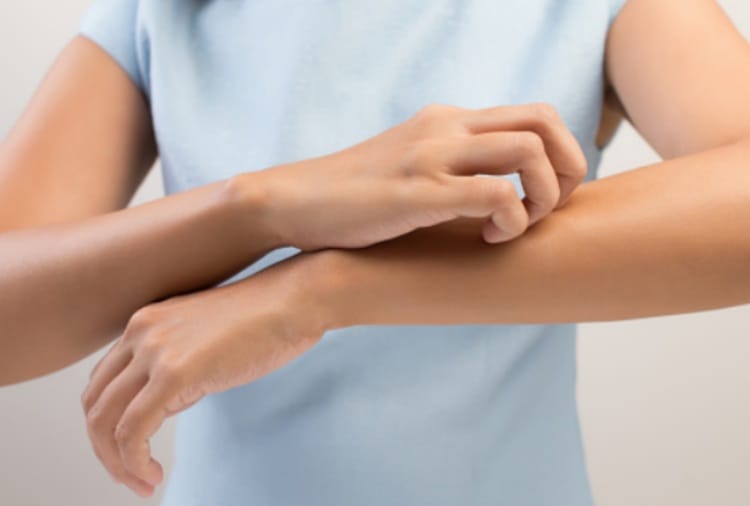 Heat, Summer Season, Home Remedies for Skin Disease