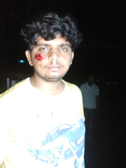 Bomb blast in student dispute, two injured including student leader in Bhadohi