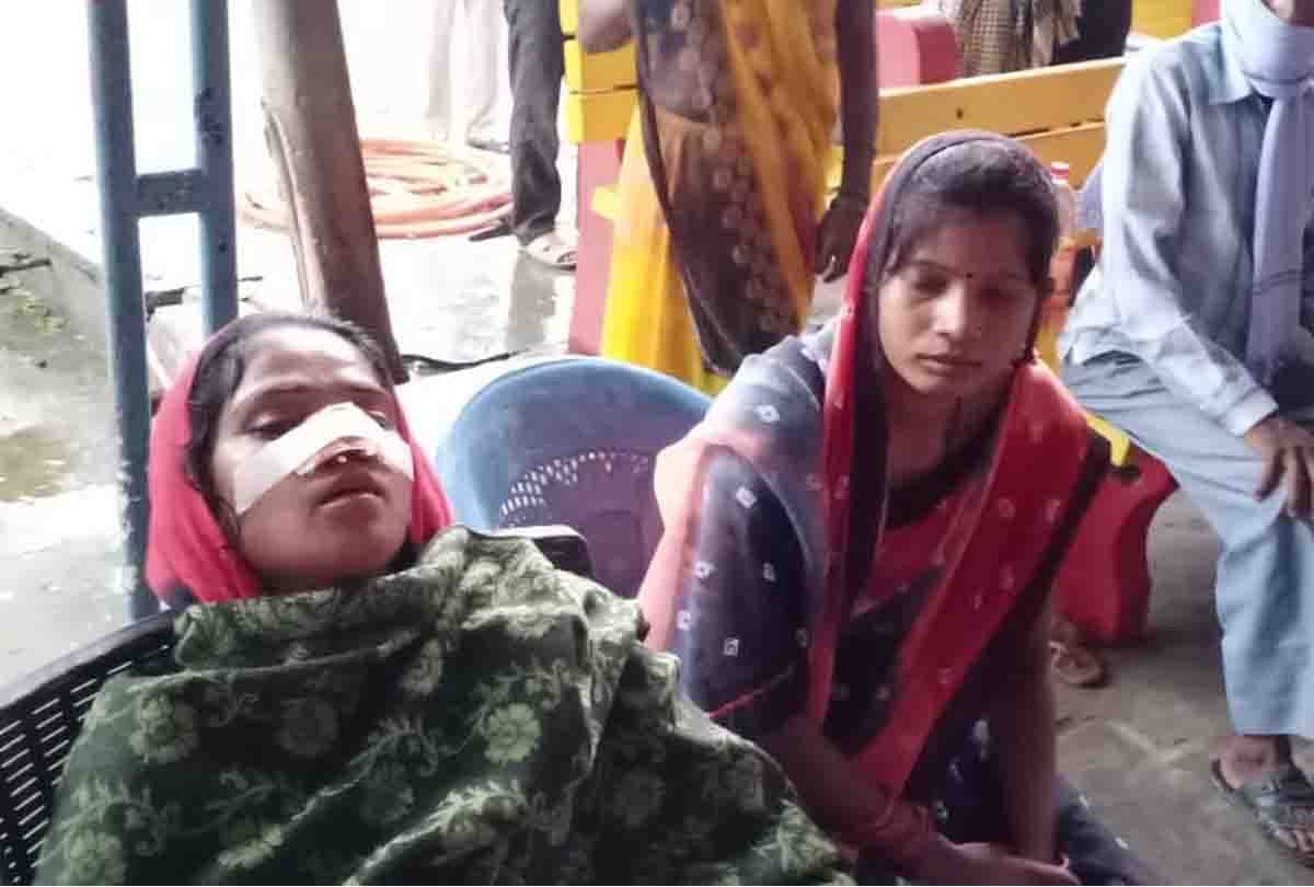 husband cut nose of wife after fight