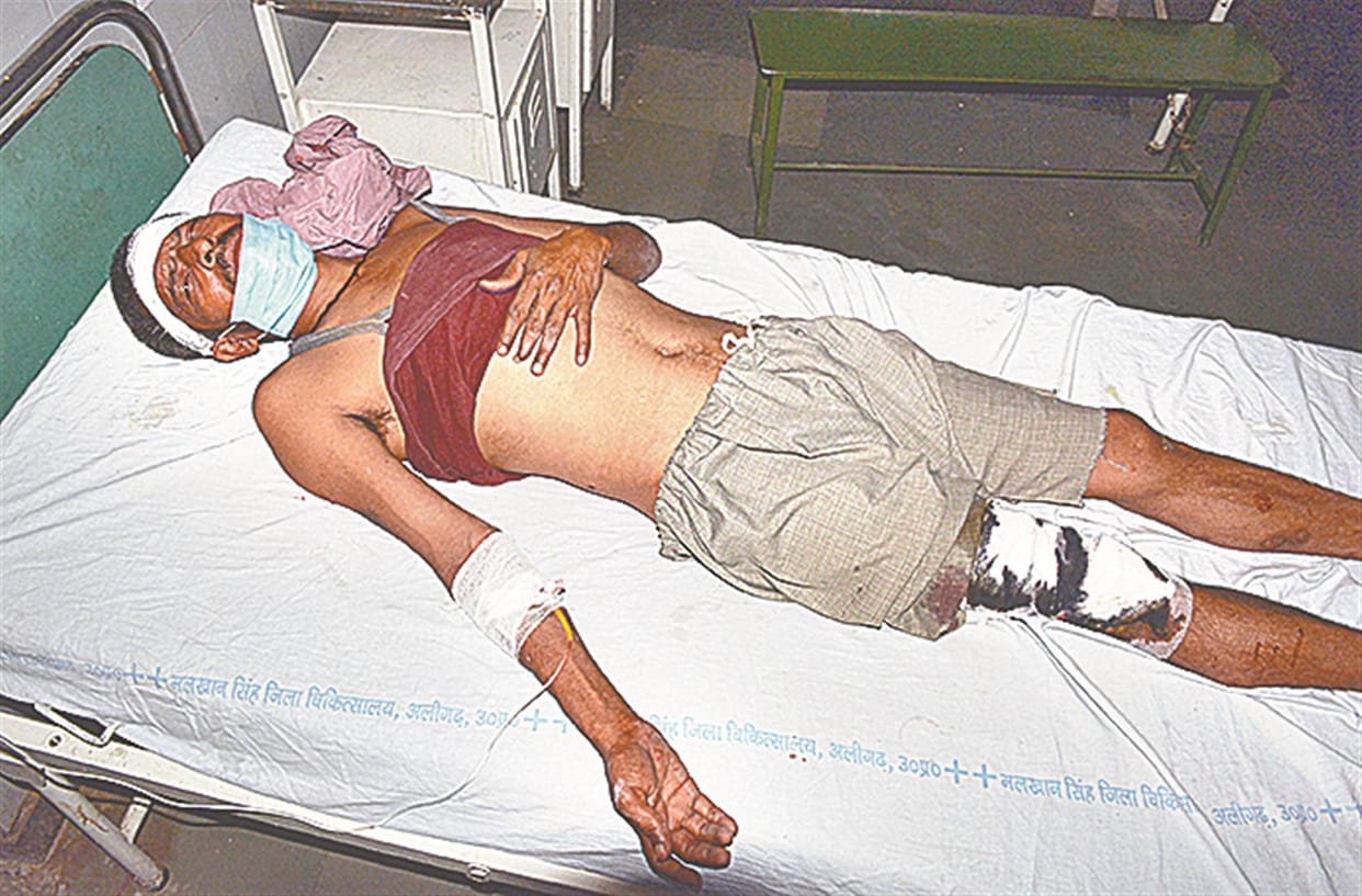 CMS guard fired due to negligence, passer injured
