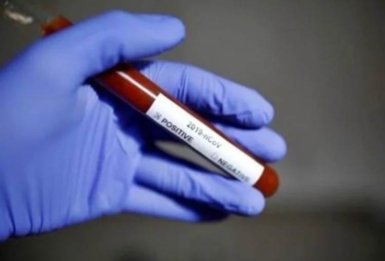 40 corona positive found in lucknow