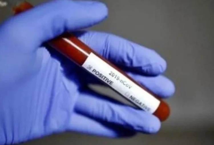 three patients died due to coronavirus in lucknow