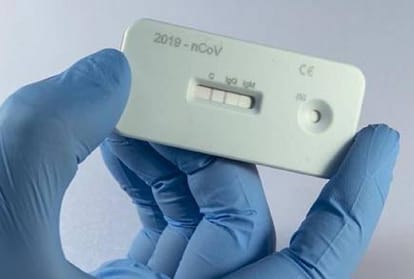 Prayagraj Corona News: Detection of infected people intensified with antigen test