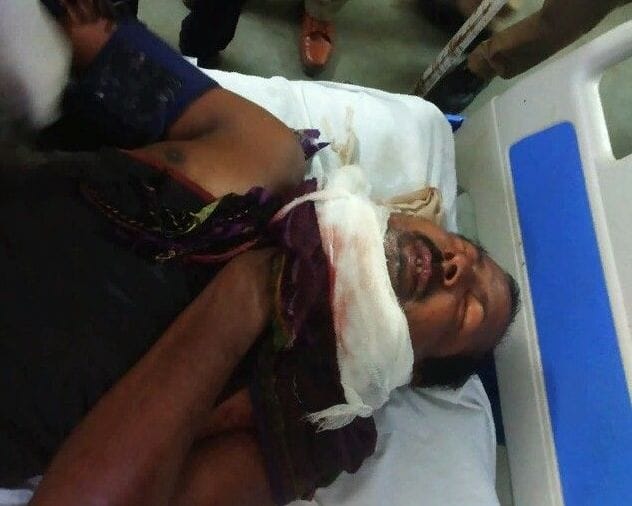 firing for daku goppa in chitrakoot