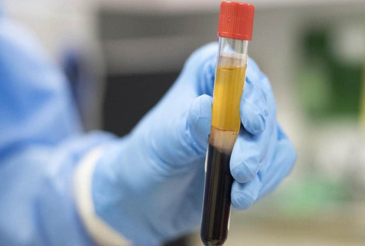 Coronavirus In India : Delhi governments eight schemes are proving effective in preventing spread of corona virus