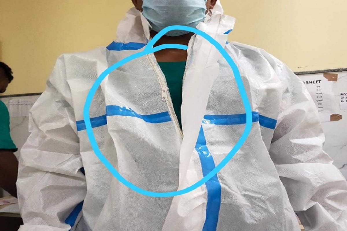Meerut News: eye shield broken, ppe kit torn in Medical College Meerut