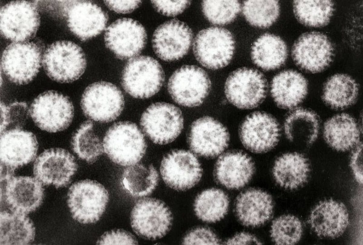 What is Rotavirus and its Symptoms Causes Treatment and Prevention