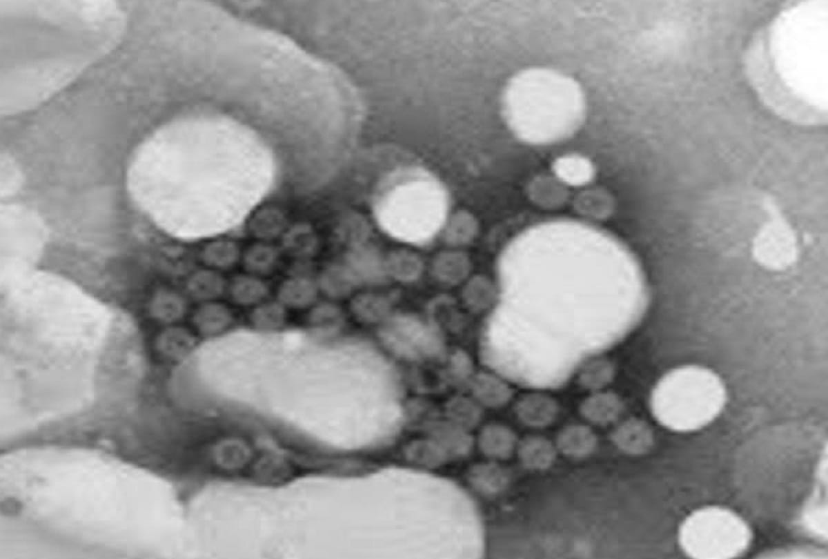 What is Rotavirus and its Symptoms Causes Treatment and Prevention