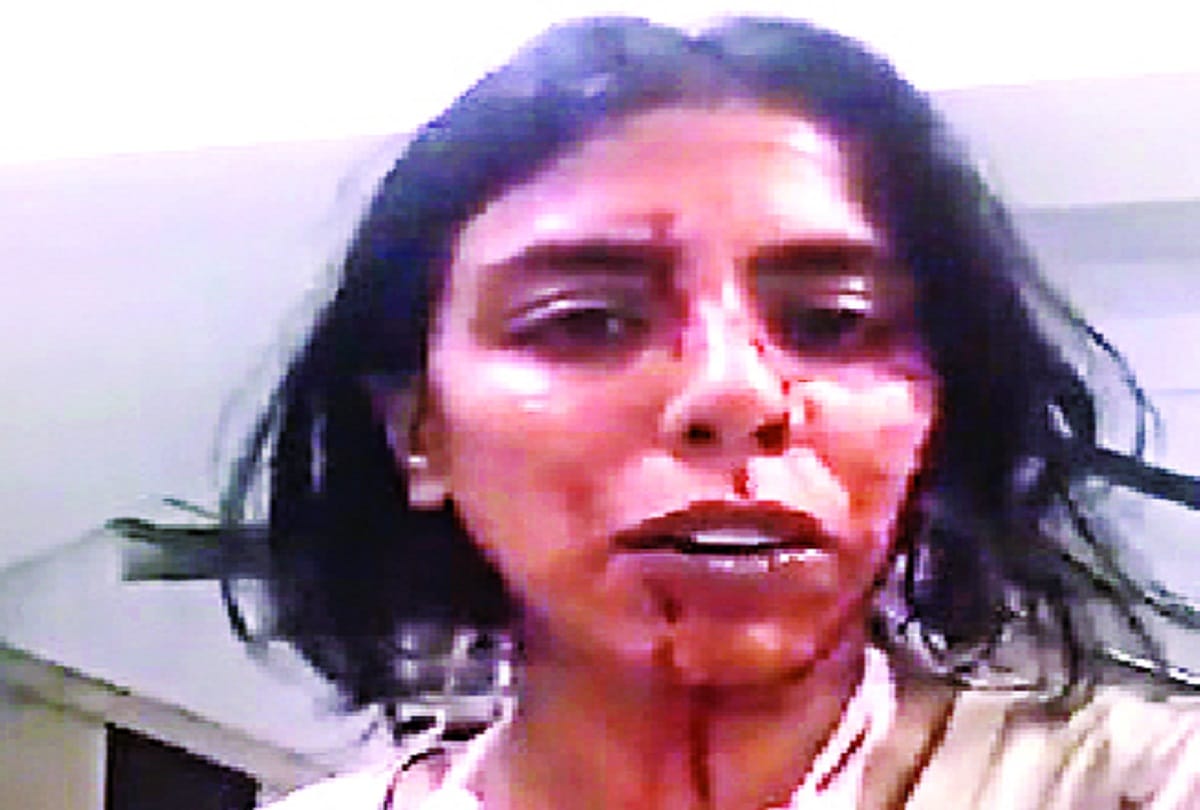 NGO team helping abandoned dogs attacked in delhi
