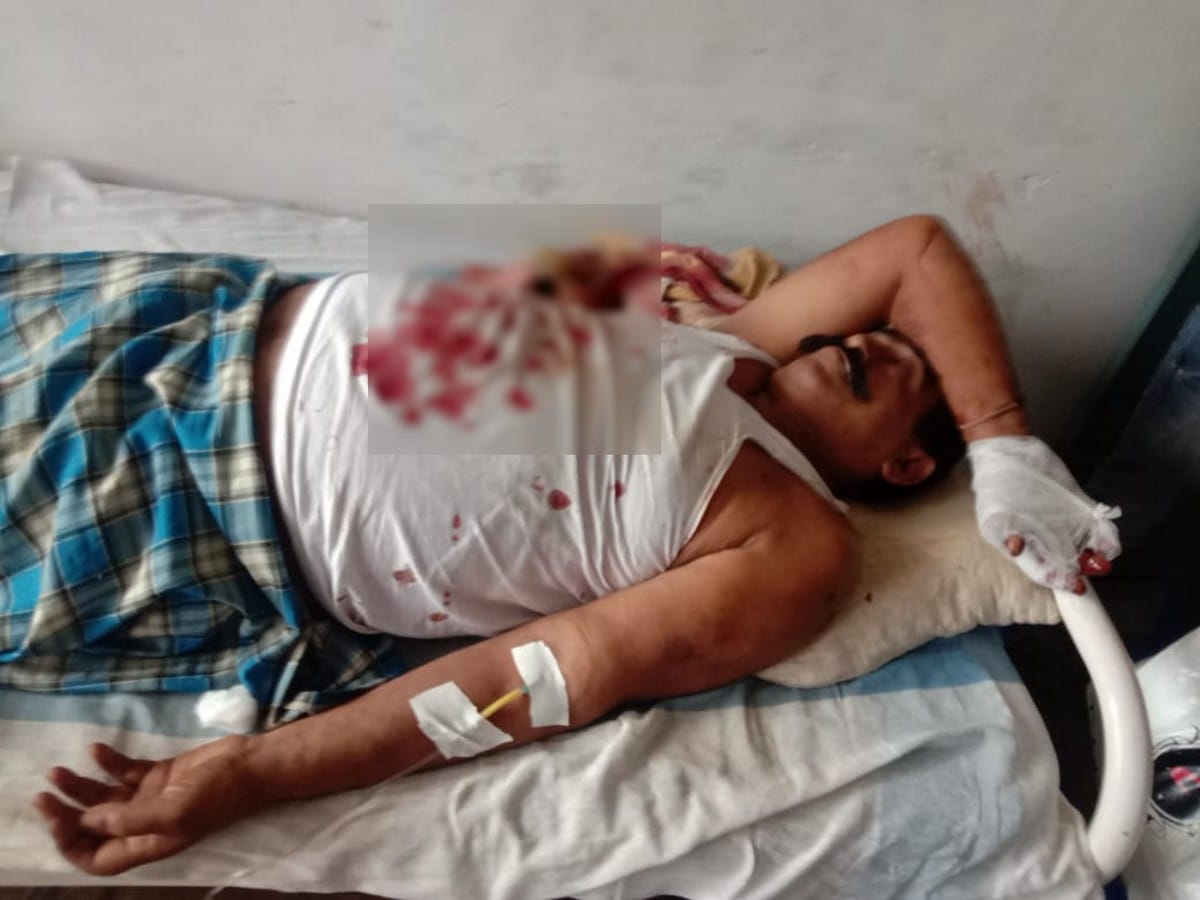 Younger brother firing elder brother family in land dispute in azamgarh up