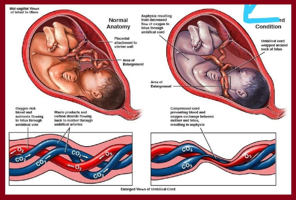 houston mom gives birth triplets beat coronavirus, a pregnant woman became mother after beating Covid 19