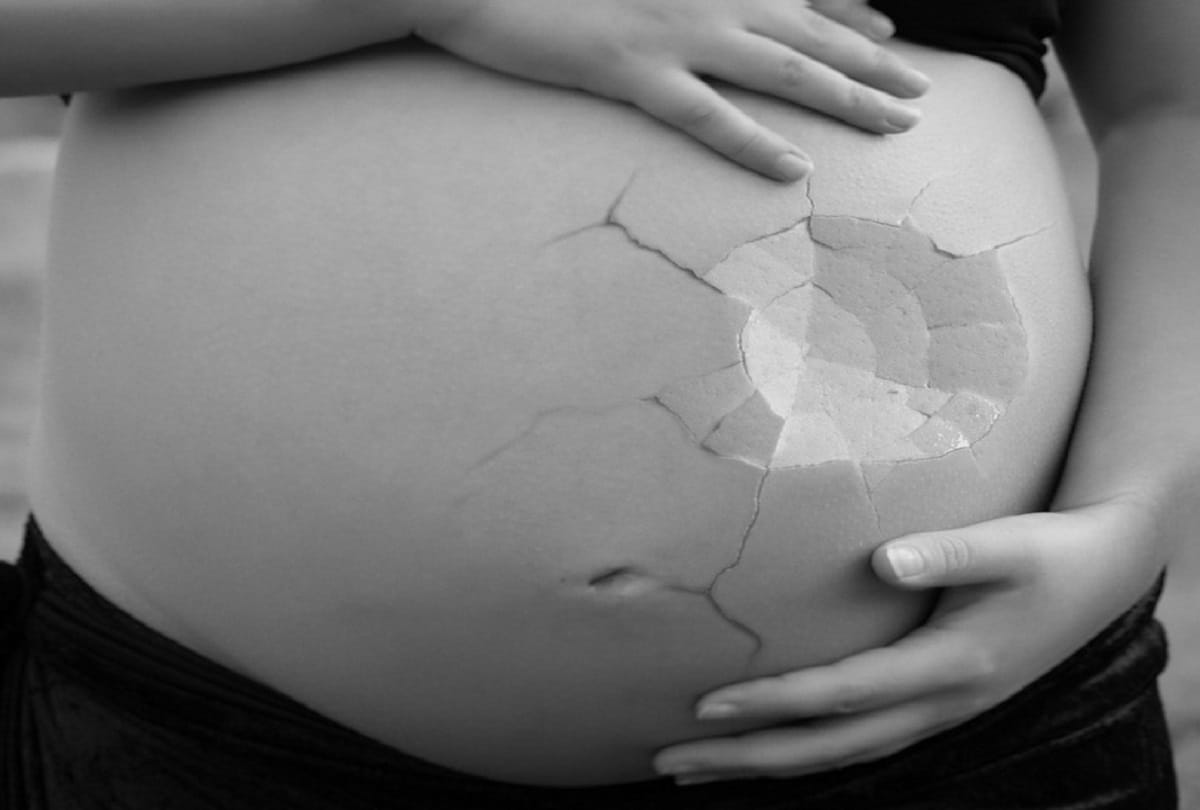 If virus were not in the world human would lay eggs instead of giving birth