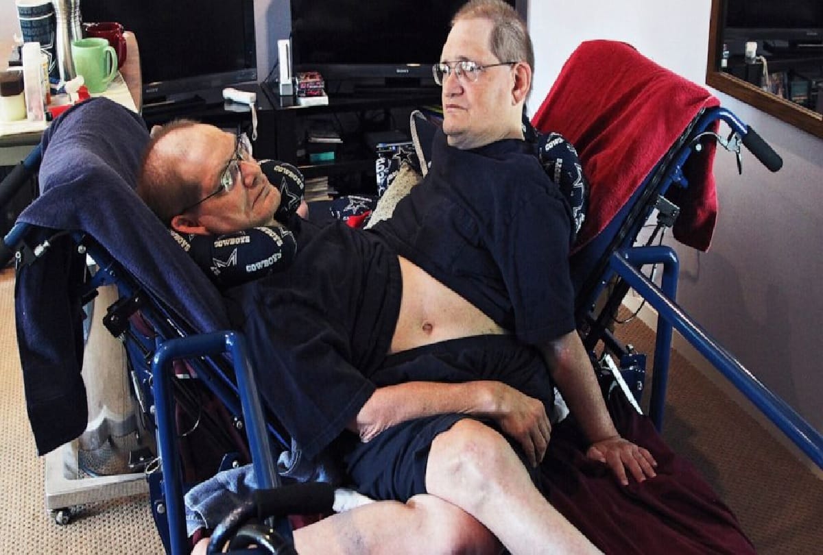 world oldest conjoined twin brothers die in 68 years in america