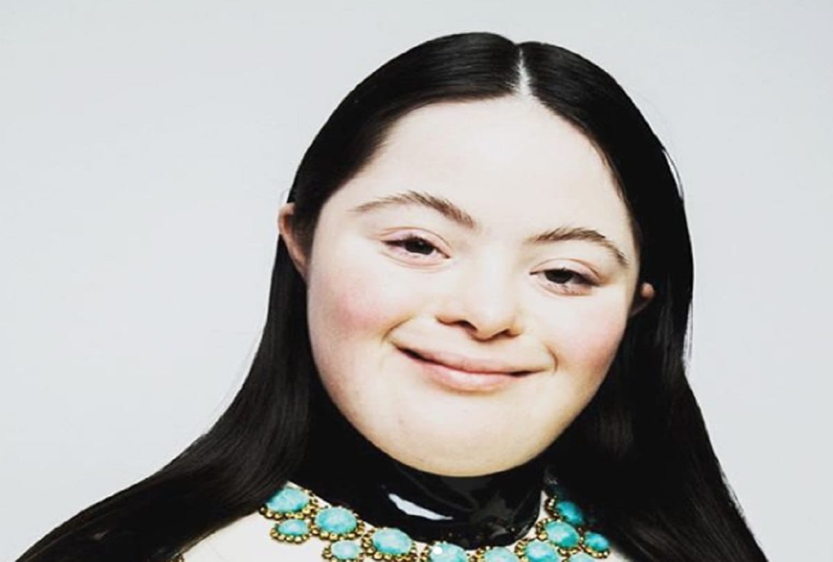 Ellie Goldstein worlds first model with Down syndrome