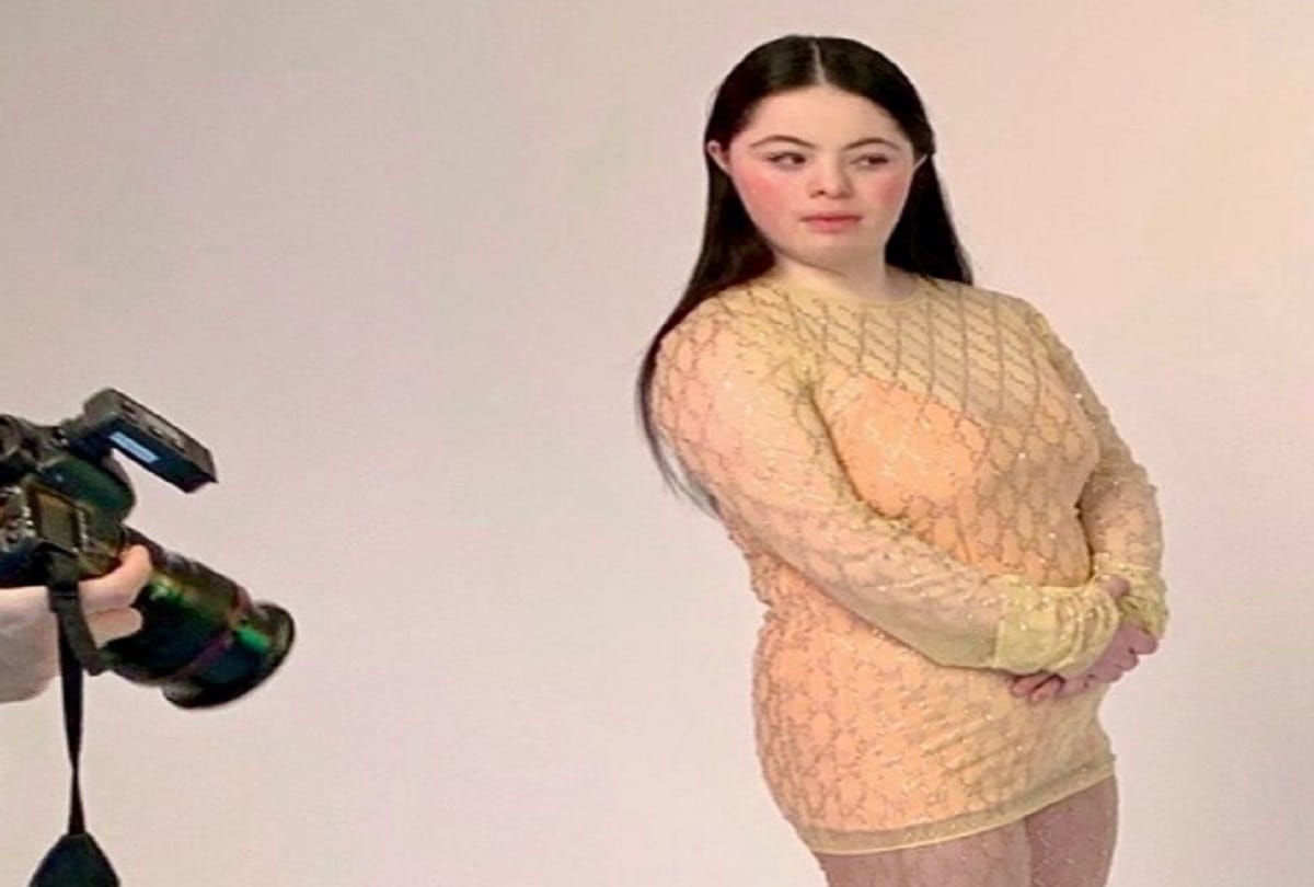 Ellie Goldstein worlds first model with Down syndrome