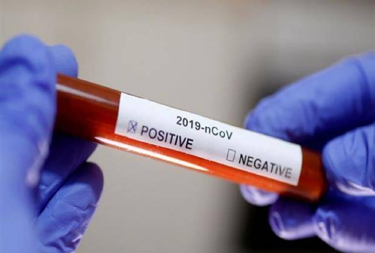 Prayagraj Corona Updates: 49 new corona patients found in Prayagraj, number of infected 534