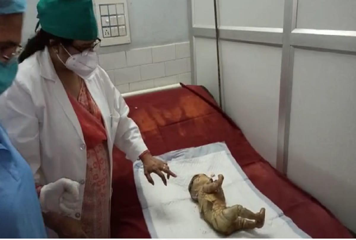 A strange child born in Aligarh
