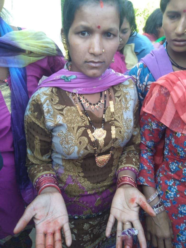 sharaab aur jue ka virodh kar rahee mahilaon par hamala, ek mahila ghaayal