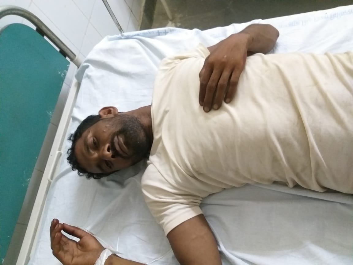 Aligarh: 50 thousand prize smuggler injured in police encounter, nabbed