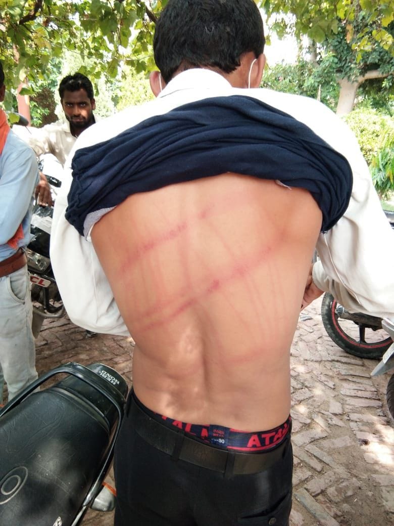 Aligarh: fight with meter reader, snatch money