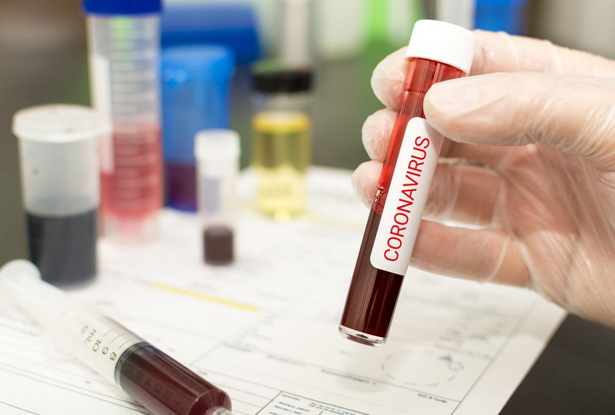 Corona Patients not catching due to change in variant of Covid 19
