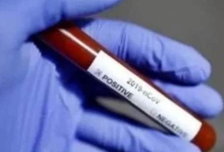 corona infection is spreading less rate in uttar pradesh, positivity rate is of 2 % in country, 0.2% in UP