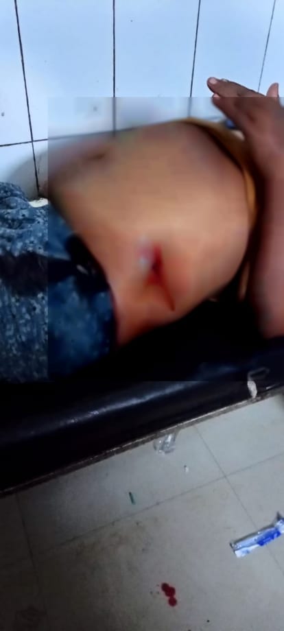 Criminal attacked on village firing on villagers three caught many injured in ballia up