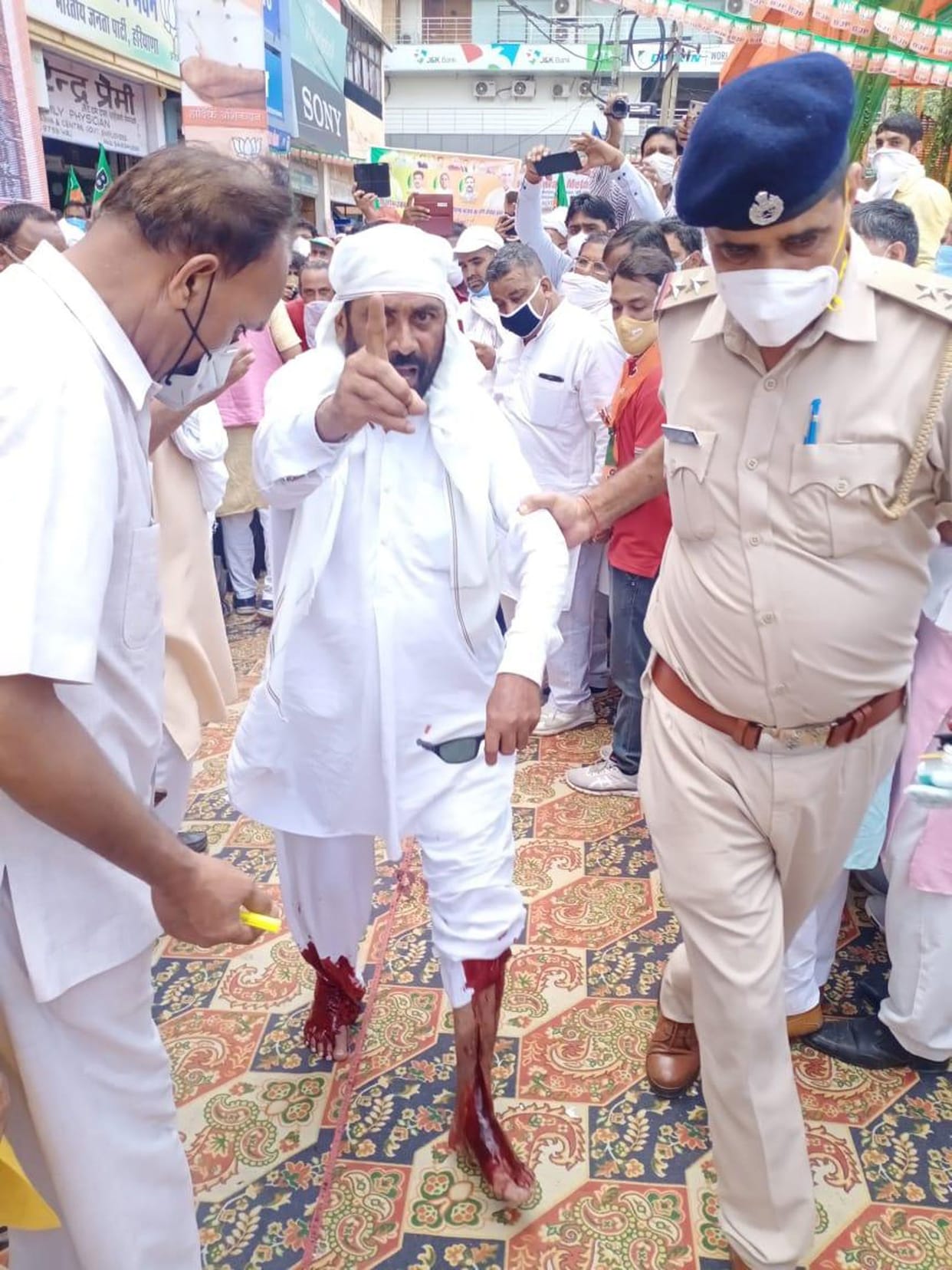 In the program of CM, the man cut the nerve of the leg, DC said - is addicted to drugs, case registered