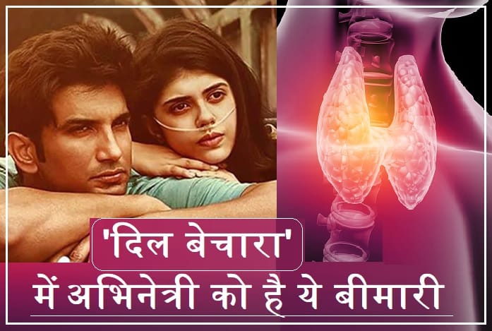 dil bechara actress disease Thyroid Cancer symptoms cause treatment Sushant Singh rajput last movie sanjana sanghi