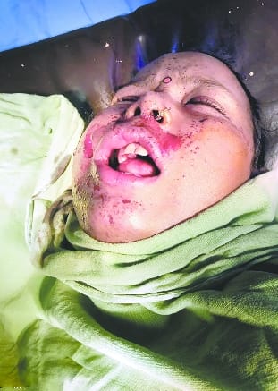 Landlord shot dead for rent, condition critical