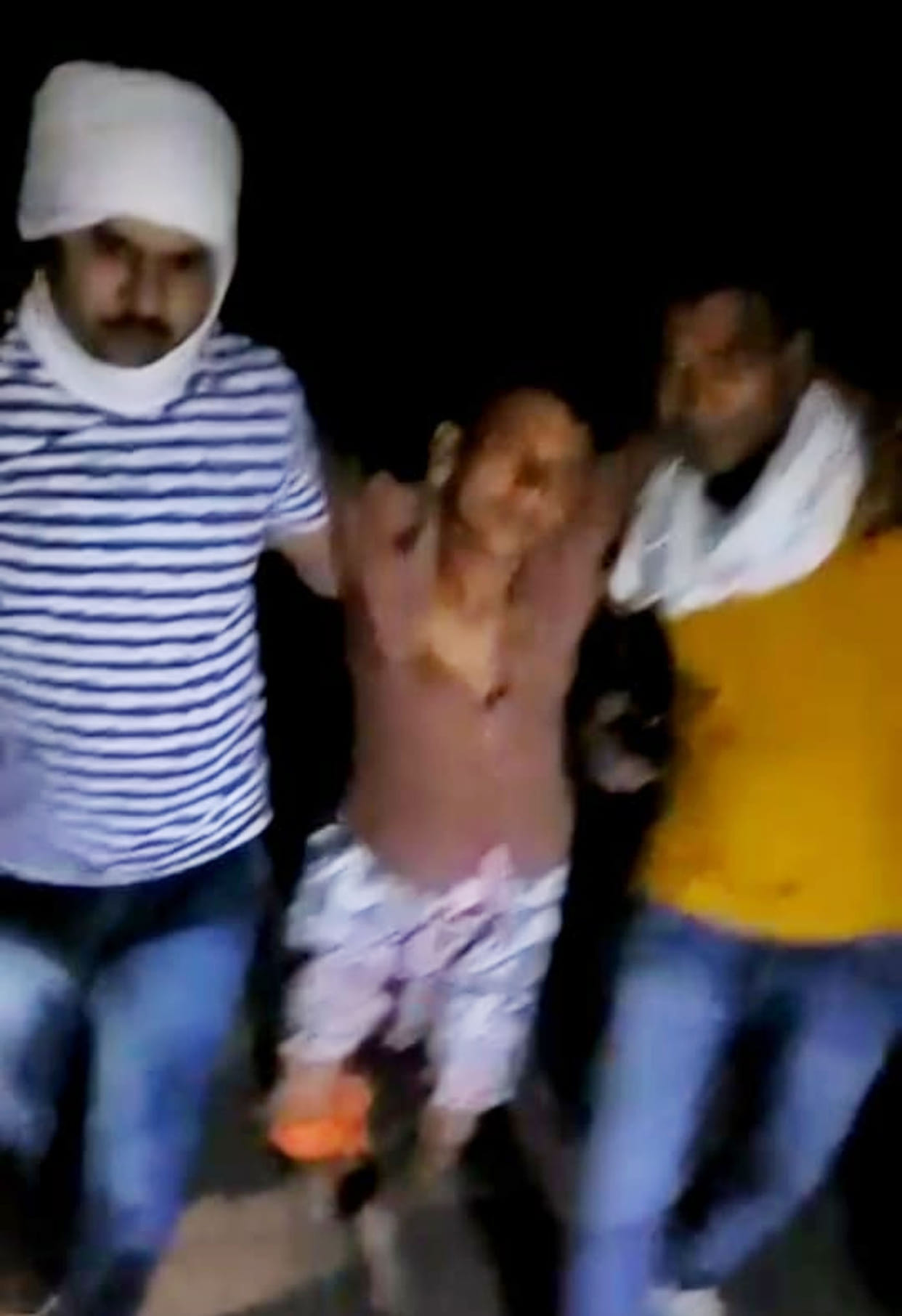 Robber injured in encounter, partner absconding
