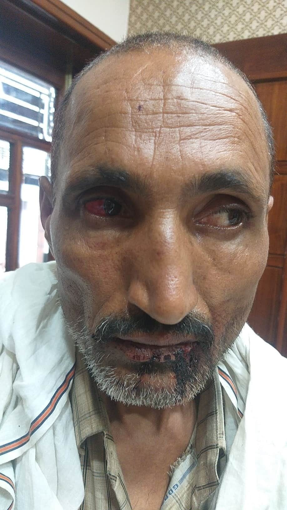 Dhaba operator asked for 200 rupees for eating three bread and pulses, beaten on account, did not get treatment in civil hospital