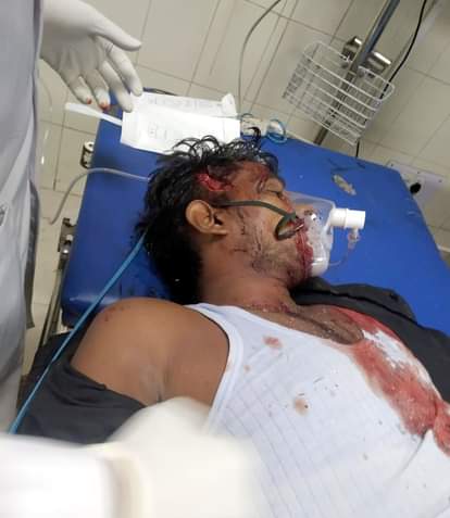 जेएन मेडिकल कॉलेज में भर्ती घायल।
