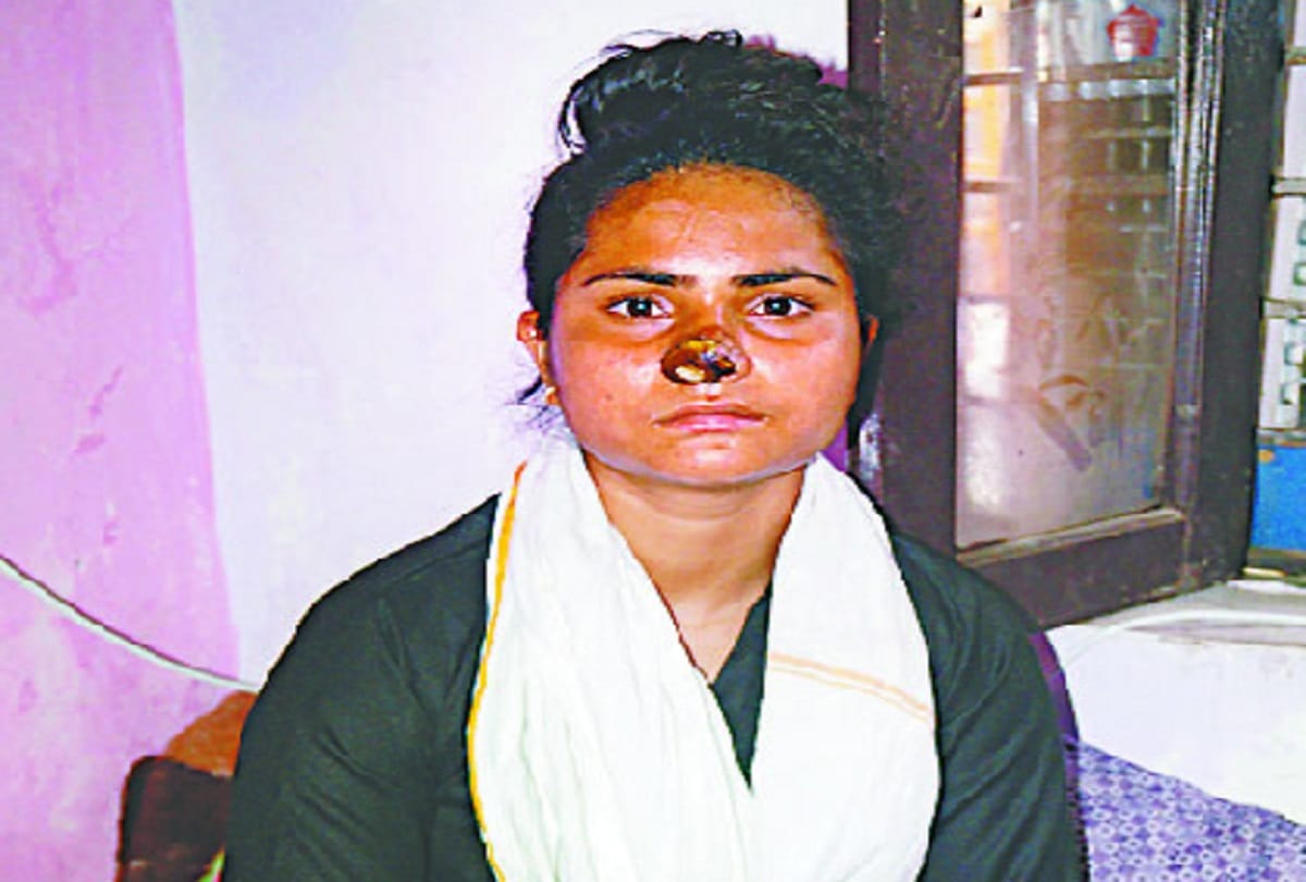 mother and sister beat and cut the nose of younger sister